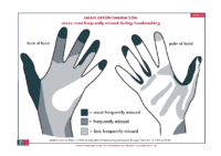 hand areas missed poster